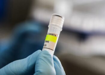 Hantavirus much less contagious than COVID-19, says Dutch doctor