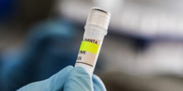 Hantavirus much less contagious than COVID-19, says Dutch doctor