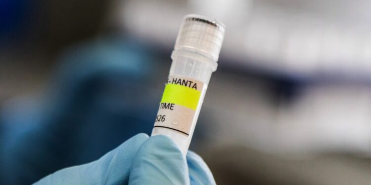 Hantavirus much less contagious than COVID-19, says Dutch doctor